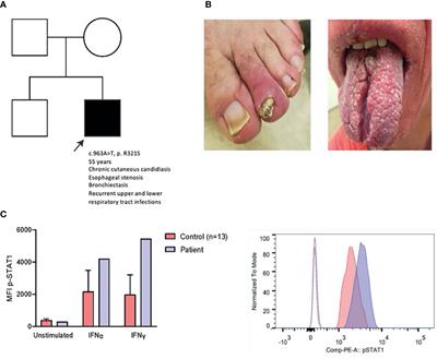 Case report: Myocarditis in congenital STAT1 gain-of function